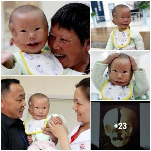 The whole family was shocked: The mother was shocked to see her 𝘤𝘩𝘪𝘭𝘥 𝐛𝐨𝐫𝐧 with 2 faces